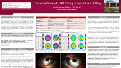 61B: The Importance of HVID Testing in Contact Lens Fitting