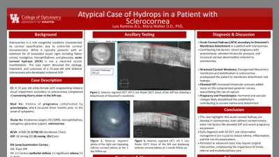 05B: Atypical Case of Hydrops In A Patient With Sclerocornea