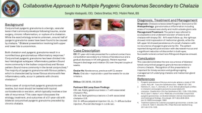 Collaborative Approach to Multiple Pyogenic Granulomas Secondary to Chalazia