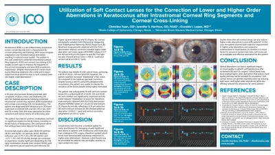 Utilization of Soft Contact Lenses for the Correction of Lower and Higher Order Aberrations in Keratoconus after Intracorneal Ring Segments and Corneal Cross-Linking