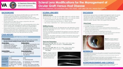 Scleral Lens Modifications for the Management of Graft-Versus-Host Disease