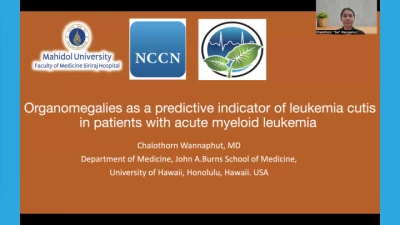 Organomegalies as a Predictive Indicator of Leukemia Cutis in the Patients with Acute Myeloid Leukemia