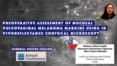 Preoperative Assessment of Vulvar Melanoma Surgical Margins Using in Vivo Reflectance Confocal Microscopy