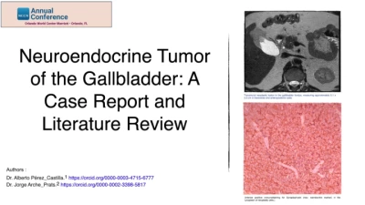 Neuroendocrine Tumor of the Gallbladder. A Case Report and Literature Review.