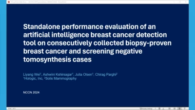 Standalone Performance Evaluation of an Artificial Intelligence Breast Cancer Detection Tool on Consecutively Collected Biopsy Proven Breast Cancer and Screening Negative Tomosynthesis Cases