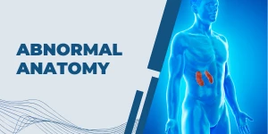 Abnormal Anatomy