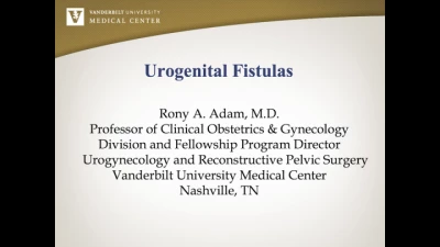 Urogenital Fistulas icon
