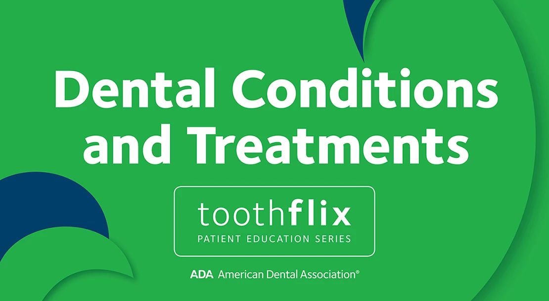 Toothflix Dental Conditions and Treatments