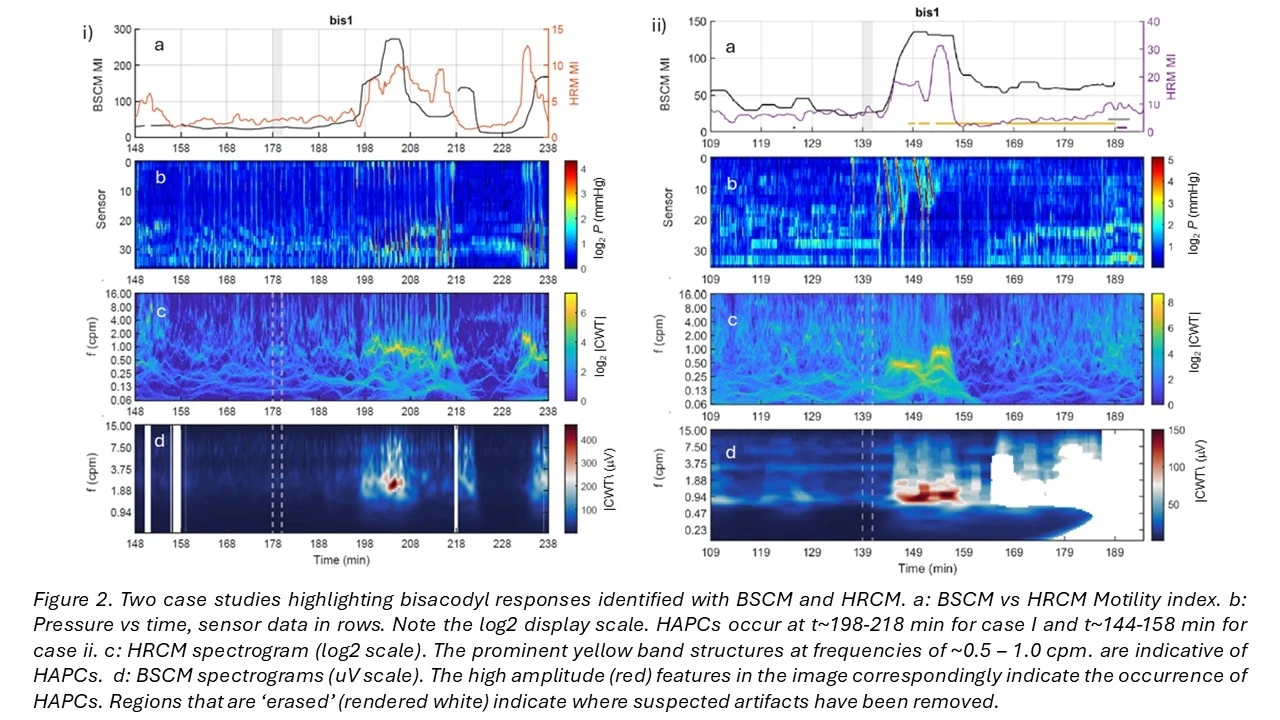 Colonic Manometry Radiology BODY SURFACE COLONIC MAPPING CORRELATES WITH HIGH RESOLUTION COLONIC ...