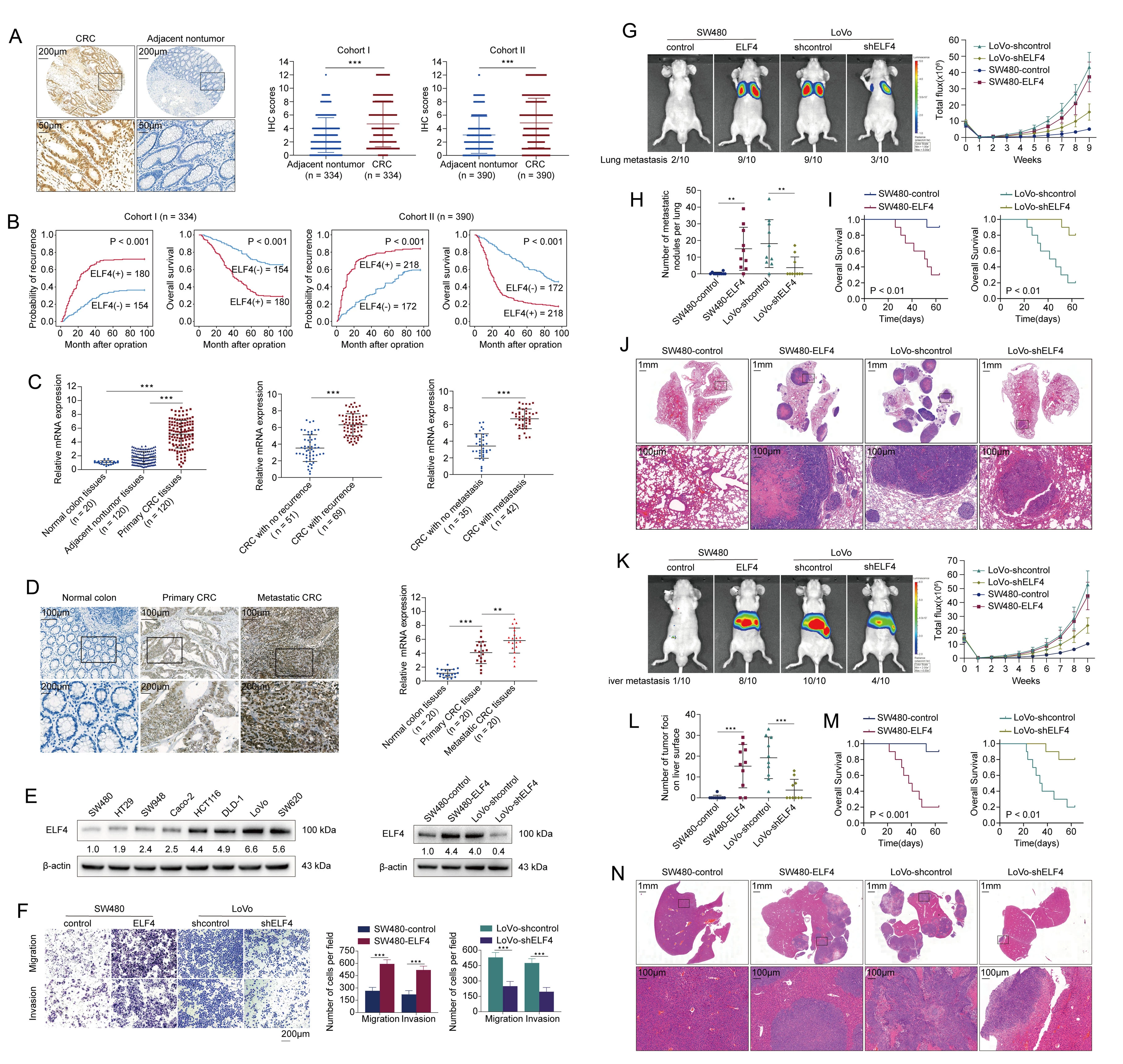 Figure 1. Elevated expression of ELF4 facilitates CRC metastasis and indicates poor prognosis in human CRC patients. (A) IHC images and scores of ELF4 expression in CRC tissues and adjacent nontumor tissues. (B) Kaplan-Meier analysis of the correlation of ELF4 expression with overall survival and recurrence. (C) ELF4 mRNA levels in CRC tissues and adjacent nontumor tissues. (D) IHC images and scores of ELF4 staining in primary CRC and paired metastatic CRC tissues. (E) Western blotting analysis. (F) Transwell assays. (G-J) ELF4 promotes CRC lung metastasis <i>in vivo</i>. (G) Bioluminescence images and mice lung metastasis incident rates. (H) Number of lung metastatic nodules. (I) Overall survival. (J) H&E staining of lung tissues. (K-N) ELF4 promotes CRC liver metastasis<i> in vivo. </i>(K) Bioluminescence images and mice liver metastatic rates. (L) Number of tumor foci on liver surface. (M) Overall survival. (N) H&E staining of liver tissues.