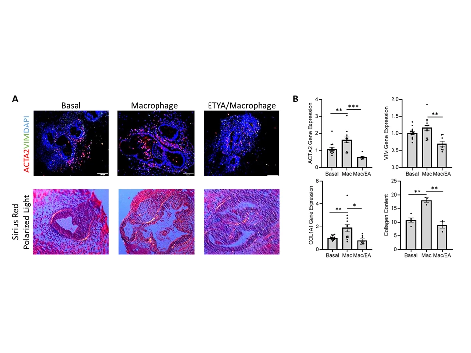 Figure 2.<b> ETYA prevents up-regulation of HIO collagen content by LPS primed macrophages.</b> HIOs were studied under basal conditions, with LPS primed macrophage (Macrophage/Mac) 72 hour co-culture, or following ETYA exposure, 50 mM for 14 days, preceding LPS primed macrophage co-culture (ETYA/Macrophage & Mac/EA). A) Representative images are shown for alpha smooth muscle actin (ACTA), vimentin (VIM), and DAPI staining to localize myofibroblasts (ACTA2+) relative to HIOs (DAPI), and for Sirius red staining with polarized light microscopy (PLM) to characterize organized HIO collagen bands (arrow). B) HIO ACTA2, VIM, and collagen (COL1A1) gene expression were determined by PCR. Collagen protein was detected using Sirius red staining and polarized light microscopy (arrows). HIO collagen content was quantified using ImageJ. Data are shown as the mean (SEM), n=9-16 per group,*p<0.05, **p<0.01, ***p<0.001.
