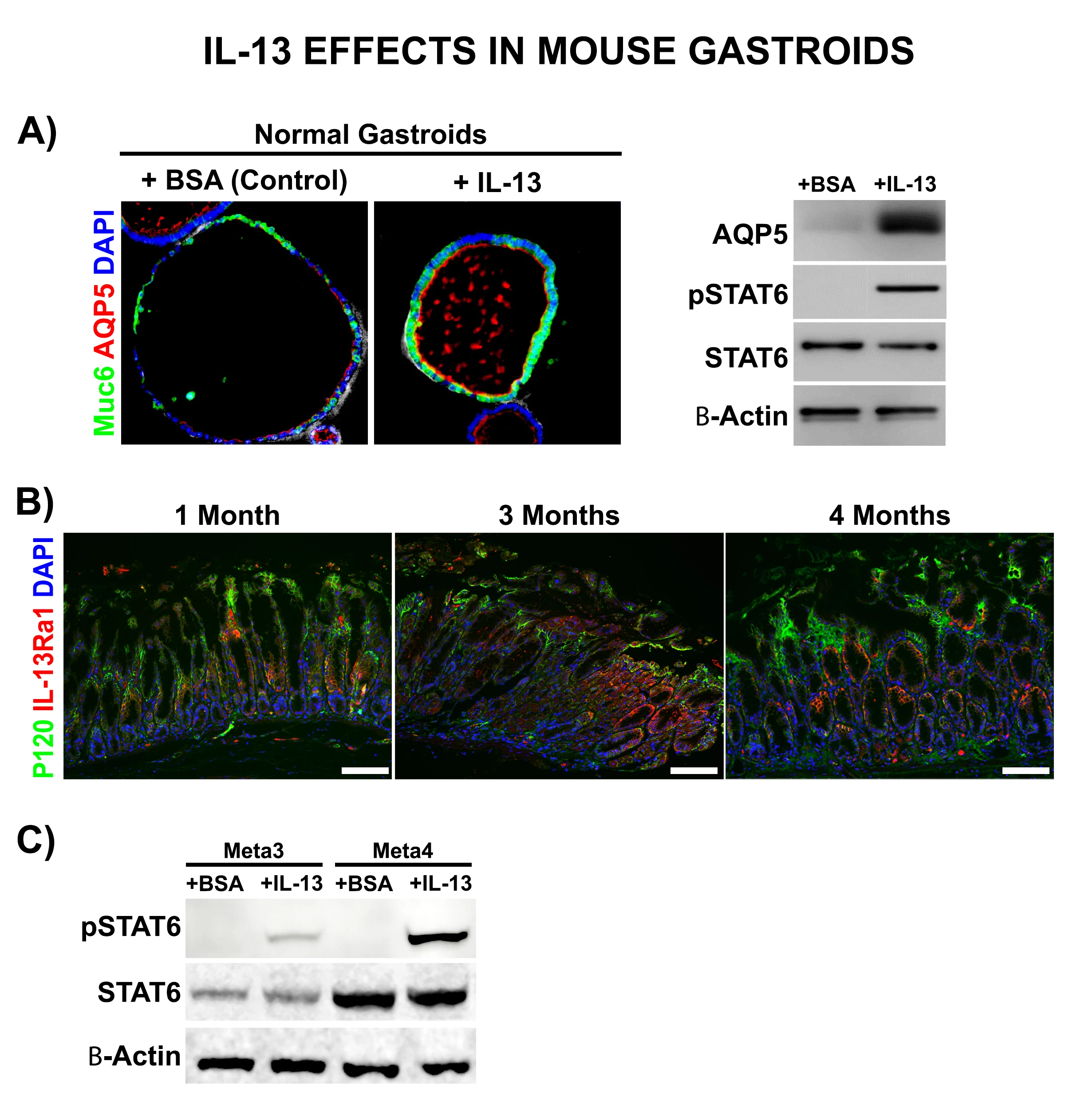 <b>Figure 1. IL-13 effects in mouse gastroids. A)</b> Left panel, Immunofluorescence staining for SPEM markers (Muc6 and AQP5) in normal gastroids, showing an increase of SPEM cell marker in IL-13-treated gastroids. Right panel, Immunoblotting showing an up-regulation of AQP5 and phosphorylated STAT6 after treatment with IL-13. <b>B)</b> Immunofluorescence staining for IL-13Ra1 and P120 (epithelial cell marker) in Mist1-Kras mouse stomach tissues after 1, 3 or 4 months of induction. <b>C)</b> Immunoblotting showing an up-regulation of phosphorylated STAT6 after treatment with IL-13 in Meta3 (IM) and Meta4 (dysplasia) gastroids.