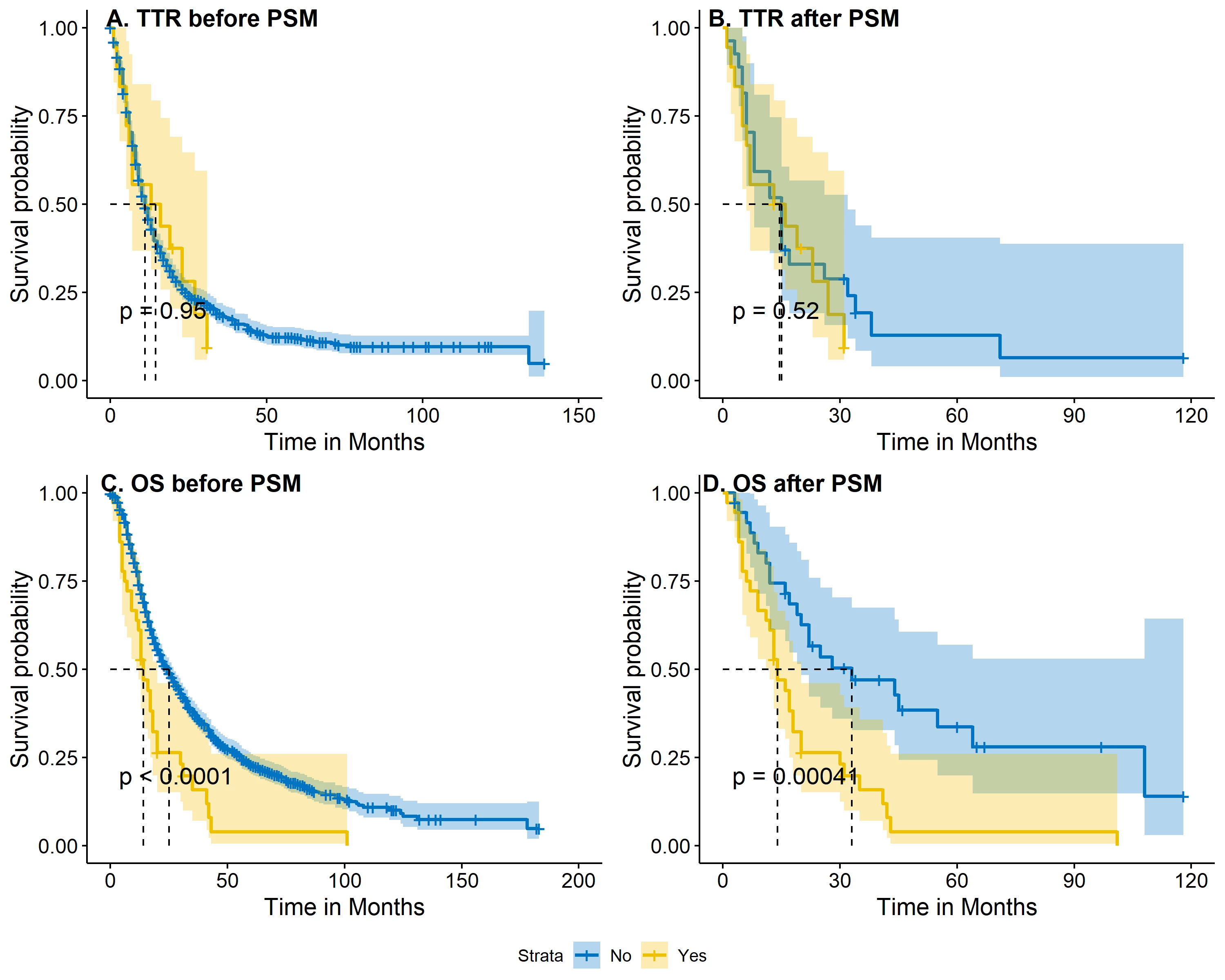 Time to recurrence and overall survival following resection of pancreatic ductal adenocarcinoma.