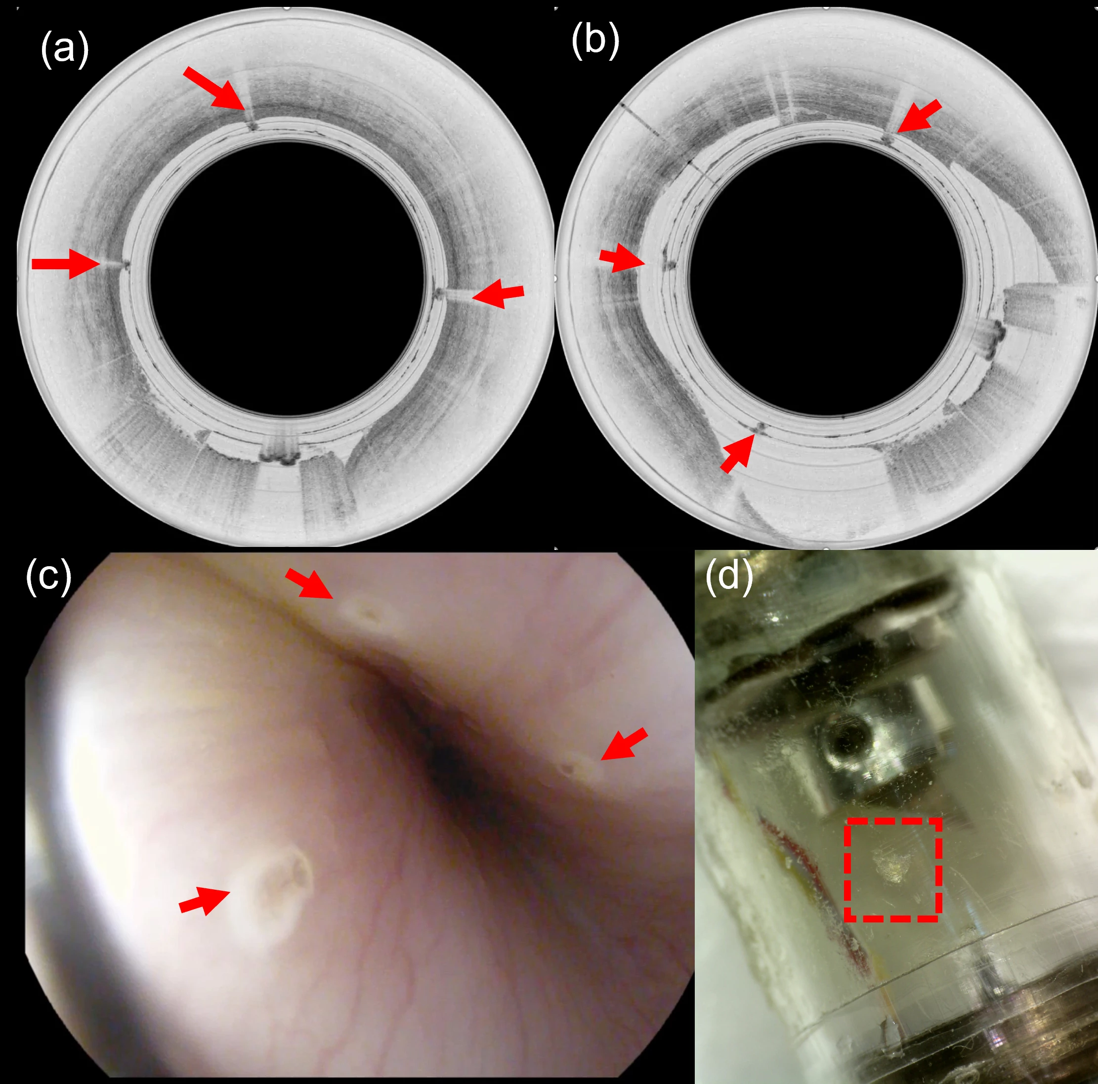 Figure 1: The IVLCM system. (a) Laser capture system. (b) OCT imaging system with the IVLCM-TCE device. (c)  The IVLCM-TCE capsule.