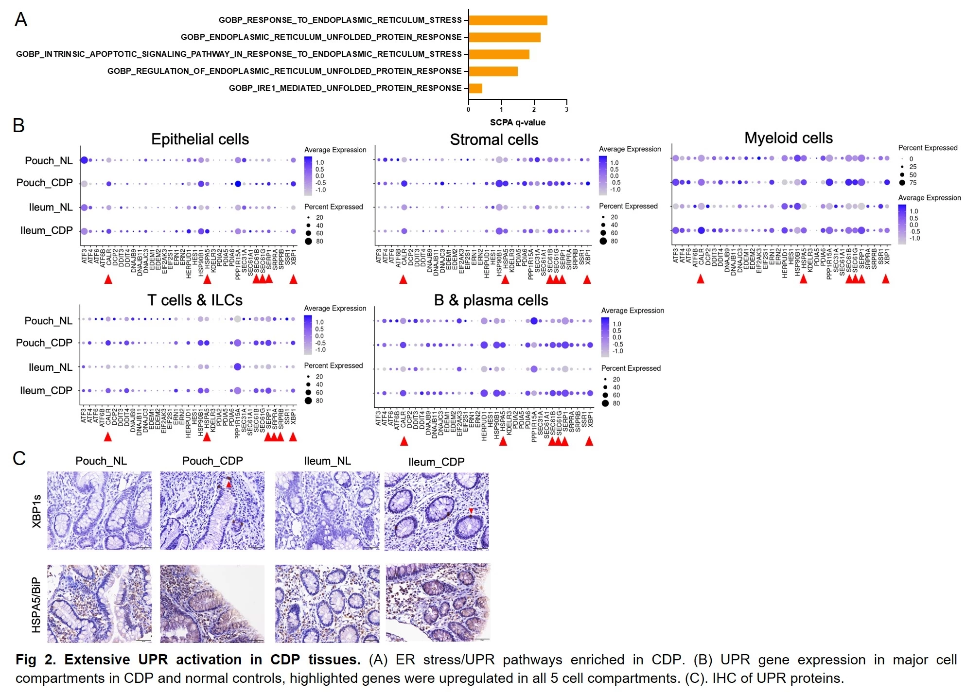 Figure 2: Crohn’s-like disease of the pouch activates extensive unfolded protein response.