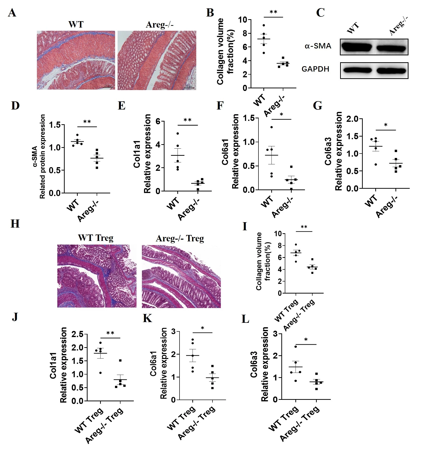 <b>Figure 1. </b>The deficiency of AREG induces less severe intestinal fibrosis. <b>(A-G) </b>WT mice and <i>Areg<sup>-/- </sup></i>mice were administered with 3 cycles of DSS insults. In each cycle, mice were given 2.0% DSS (wt/vol) in drinking water for 7 days and control drinking water for 7 days. <b>(A-B) </b>Colon tissues were stained with masson trichrome. <b>(C–D) </b>α-SMA expression in colon tissues of mice was determined by WB. <b>(E-G) </b>Col1a1, Col6a1, and Col6a3 levels in colonic tissues were measured by qRT-PCR. <b>(H-L)</b> WT and <i>Areg<sup>-/- </sup></i>T cells were cultured under Treg conditions for 5 days and then transferred into <i>Rag<sup>-/-</sup> </i>mice. (<b>H-I</b>) Intestinal fibrosis was determined by masson trichrome. (<b>J-L</b>) Col1a1, Col6a1, and Col6a3 levels in colonic tissues were measured by qRT-PCR. <sup>*</sup><i>P</i> <0.05; <sup>**</sup><i>P</i> <0.01.