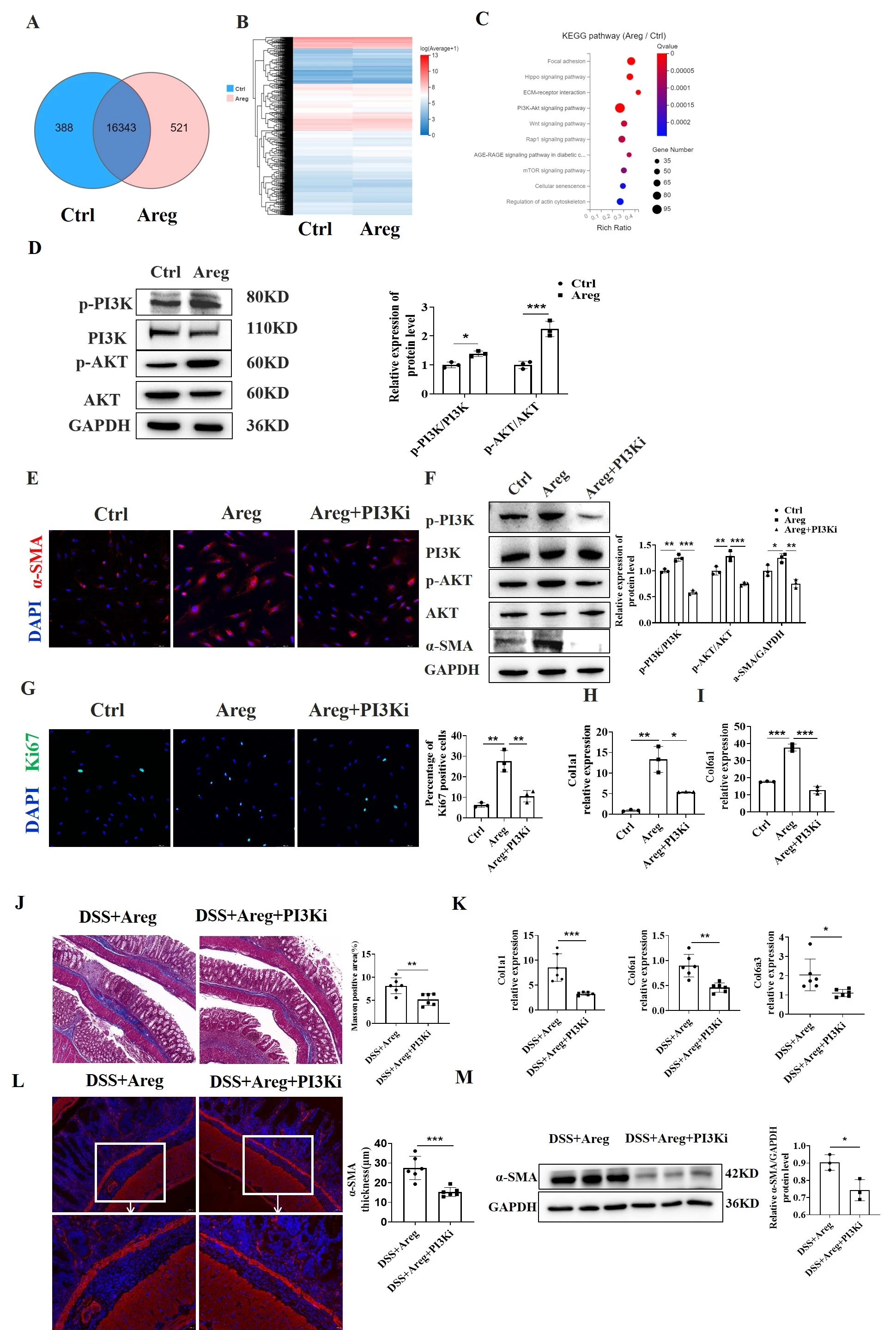 <b>Figure 2. </b>AREG promotes human intestinal myofibrosblasts (MFs) activation and proliferation through activation of PI3K/AKT pathway. Blockade of PI3K/AKT pathway suppresses intestinal fibrosis. <b>(A-D) </b>Human intestinal MFs were treated with or without AREG for 48h and then gene differences were analyzed by RNA-sequencing. <b>(E-F) </b>Human intestinal MFs were treated with or without AREG in the presence or absence of PI3K inhibitor, α-SMA were detected by IF <b>(E) </b>and WB <b>(F)</b>, and p-PI3K, p-AKT were determined by WB <b>(F)</b>. <b>(G) </b>Ki67 positive cells were analyzed by IF. <b>(H-I) </b>Col1a1 and Col6a1 expression were measured by qRT-PCR. (<b>J-M</b>) WT mice (n=6/group) were administered with 3 cycles of 1.5% DSS insults. Areg (550ng per mice) with or without LY294002 (0.5mg per mice) were injected intraperitoneally during the period of DSS administration. <b>(J-M)</b> Intestinal fibrosis was determined.