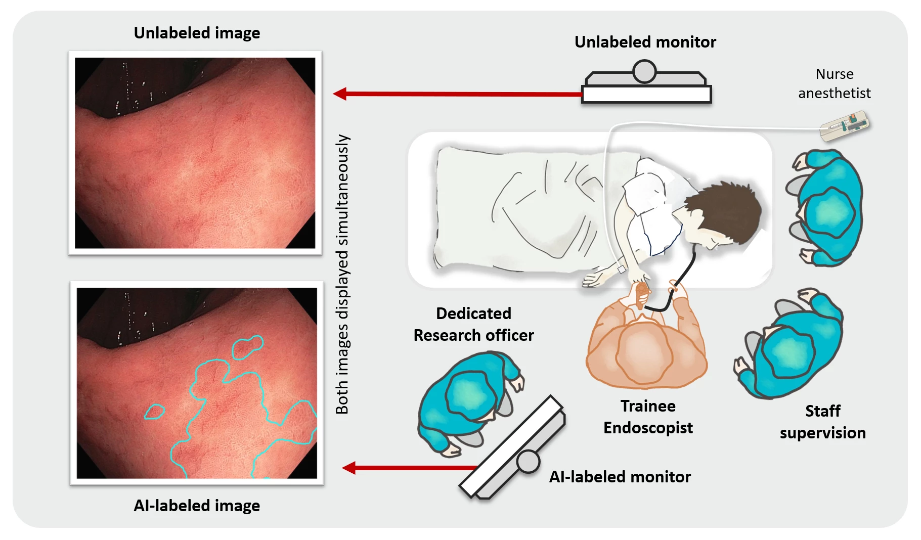 <b>Figure</b><b>:</b> Demonstrated the position of trainee endoscopist and two monitor displays, unlabeled and the other AI-labeled monitor during the study.