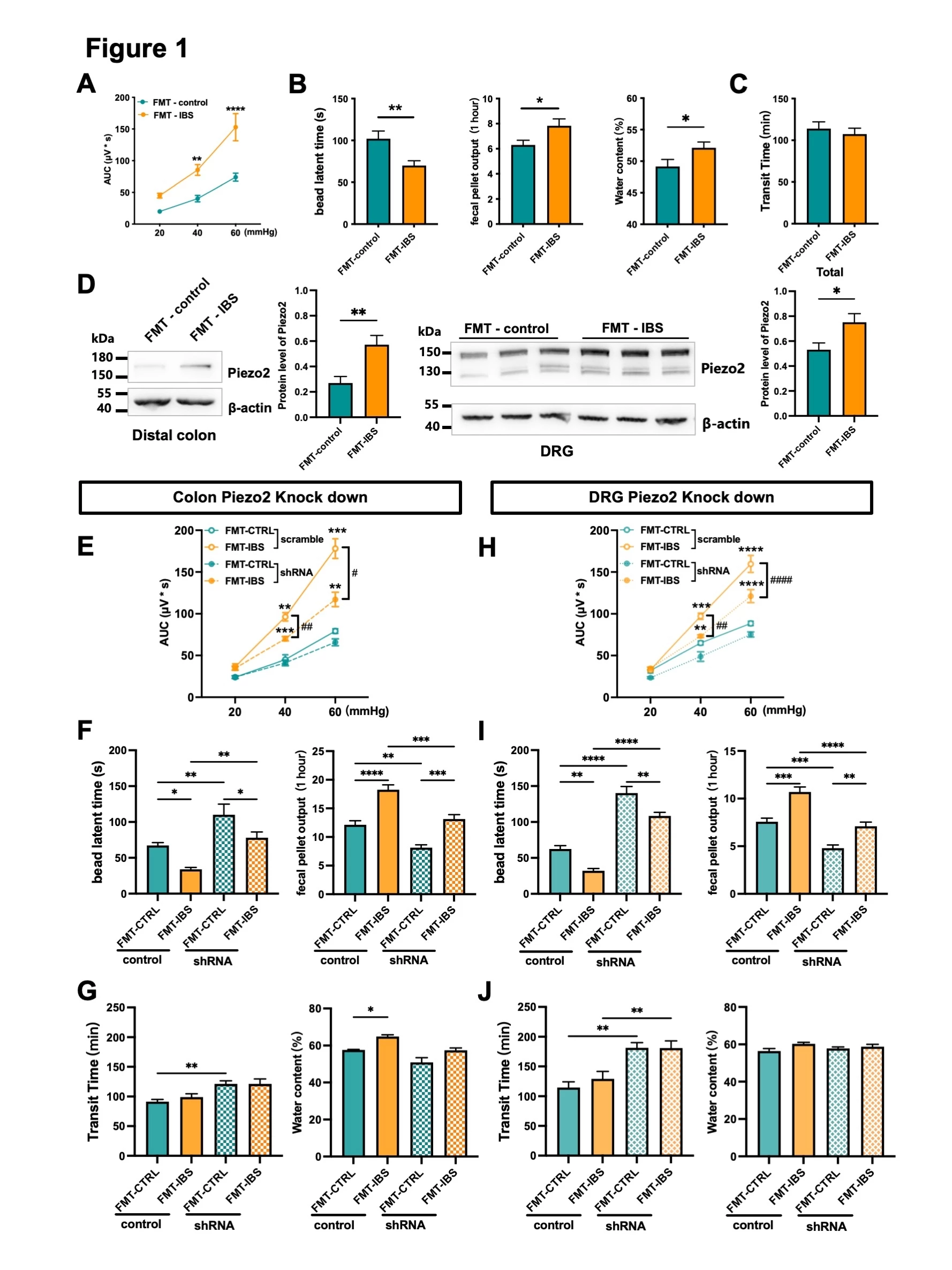 <b>Figure 1 Piezo2 receptor is involved in the development of IBS-like behavior induced by FMT of IBS patients. </b><br /> A) CRD-EMG results, B) Colon transit time, number of fecal pellets output and water content of fecal pellets, C) Whole-intestinal transit time after FMT in pGF mice. D) Piezo2 expression in distal colon and DRG neurons innervating the colon of pGF mice after FMT. E) CRD-EMG results, F) Colon transit time and number of fecal pellets output, G) Whole-intestinal transit time and water content of fecal pellets after FMT in colon Piezo2 knock down pGF mice. H) The CRD-EMG results, I) The colon transit time and the number of fecal pellets output, J) The whole-intestinal transit time and the water content of fecal pellets after FMT in DRG Piezo2 knock down pGF mice. Data are presented as the mean ± SEM. A) n = 11; B-C) n = 23; D) n = 9 – 10; E-G) n = 8; H-J) n = 7 – 10.