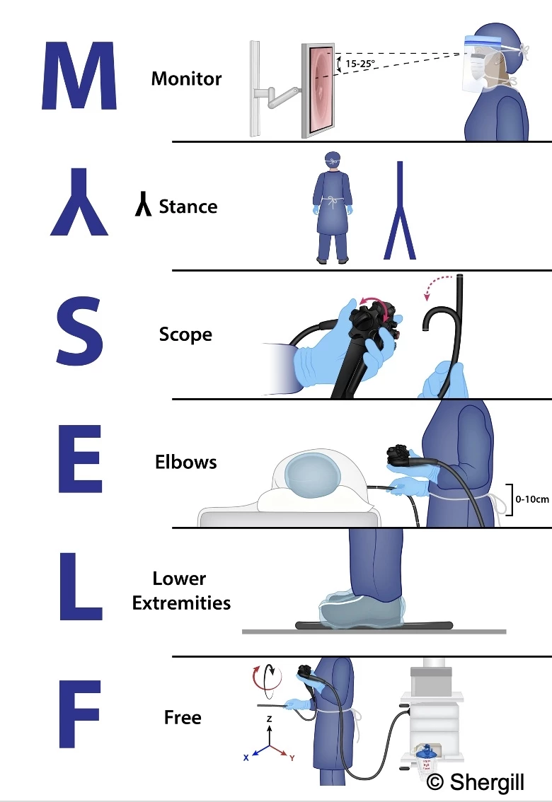 FIGURE 2. Pre-procedure ergonomic time-out: MYSELF