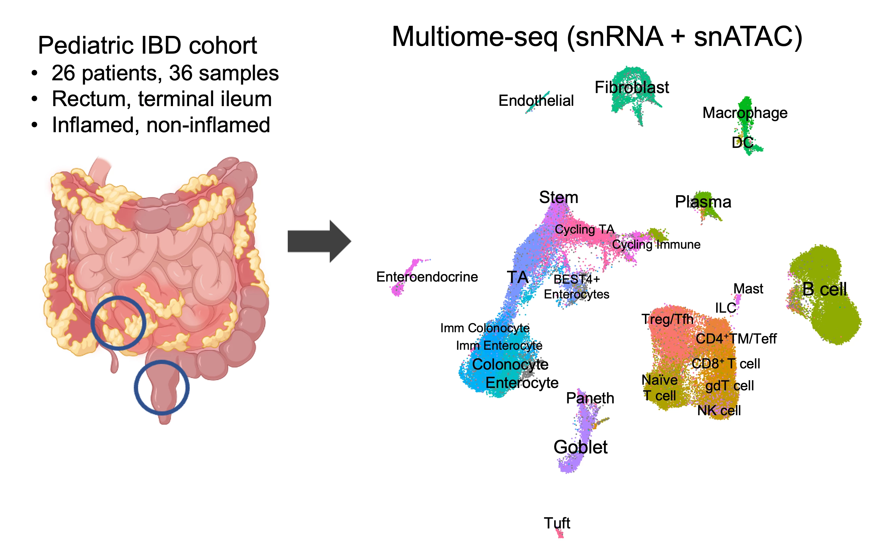 <b>Figure 1.</b> Multiome-seq was generated for 36 inflamed or non-inflamed terminal ileal and rectal biopsies of pediatric patients with CD (n=17) or UC (n=9), responsive or refractory to anti-TNFα therapy as defined by endoscopic healing. Quality control of the data yielded 258k nuclei for construction of accessible chromatin maps of intestinal cell types. DC = dendritic cell; TA = transit amplifying epithelial cell; NK cell = natural killer cell; ILC = innate lymphoid cells; CD4<sup>+</sup>TM = CD4<sup>+</sup> memory T cell; CD4<sup>+</sup>Teff = CD4<sup>+</sup> T effector cell; Treg = regulatory T cell; Tfh = T follicular helper cell.