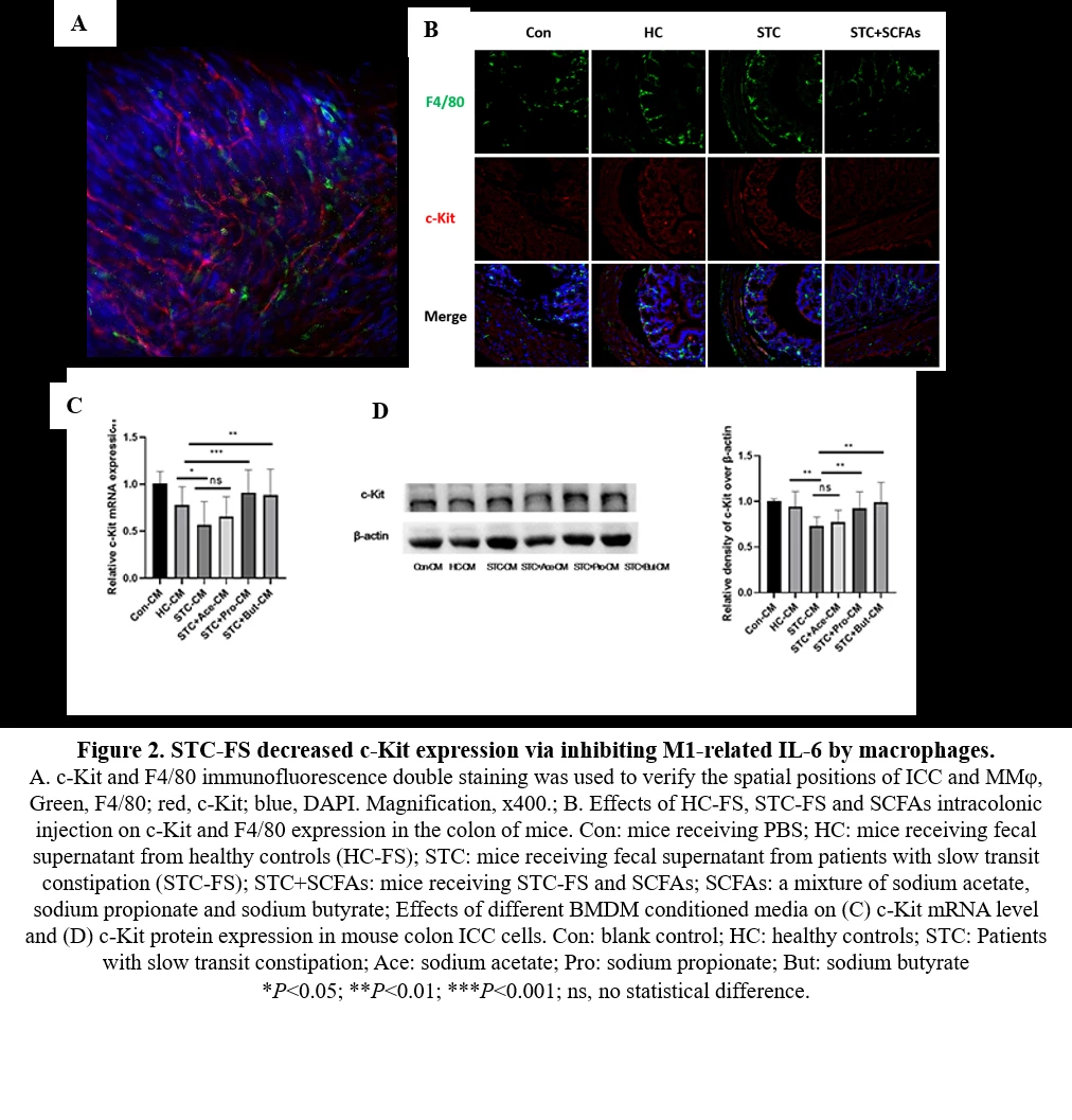 <b>Figure 2. STC-FS decreased c-Kit expression via inhibiting IL-6 by macrophages.</b>