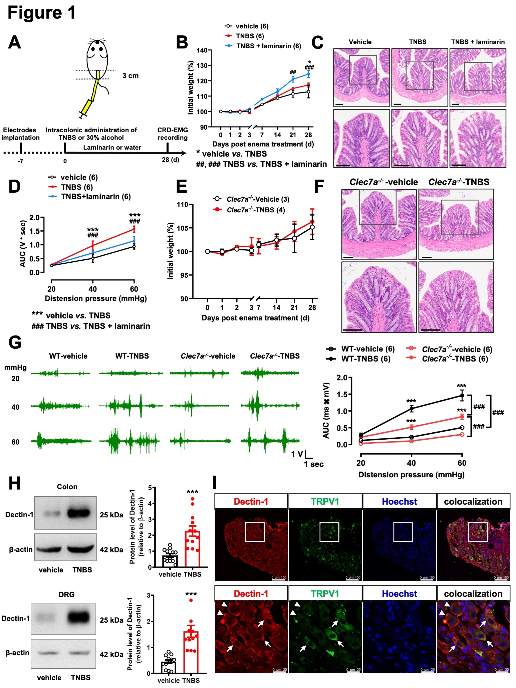 <b>Figure 1 Application of laminarin or genetic deletion of <i>Clec7a</i> alleviated TNBS-induced visceral hypersensitivity in mice</b><br /> A) Schematic diagram showing the timelines to establish the TNBS-induced visceral hypersensitivity and administer laminarin. B) The rate of body weight change. C) Images of H&E staining of colonic sections, D) CRD-EMG results on the 28th day after vehicle or TNBS injection without or with concurrent administration of laminarin. E) The rate of body weight change of in <i>Clec7a<sup>-/-</sup></i> mice. F) Images of H&E staining of colonic sections of <i>Clec7a<sup>-/-</sup></i> mice. G) CRD-EMG results on the 28th day after intrarectal injection of vehicle or TNBS in in wild-type and <i>Clec7a<sup>-/-</sup></i> mice. H) The expression of the Dectin-1 protein in the colon and T12-L1 and L6-S1 DRGs. I) Immunofluorescence (IF) staining of Dectin-1 and TRPV1 in L6 DRG. H&E Scale bar = 100 μm. IF Scale bar = 100 or 25 μm. Data are show as the means ± SEM.