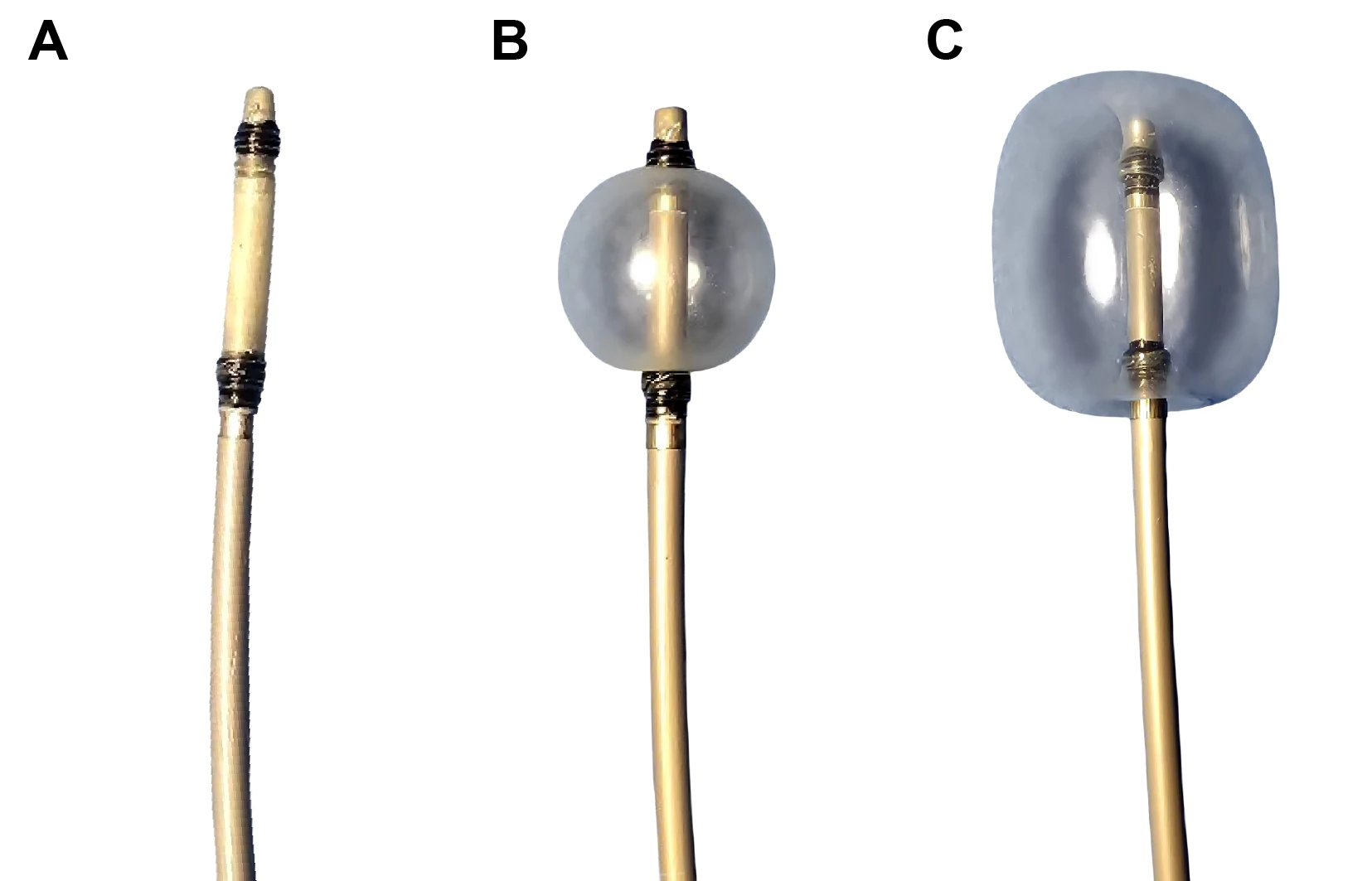 The tip of the triple-lumen balloon catheter is buried by the fully inflated balloon.