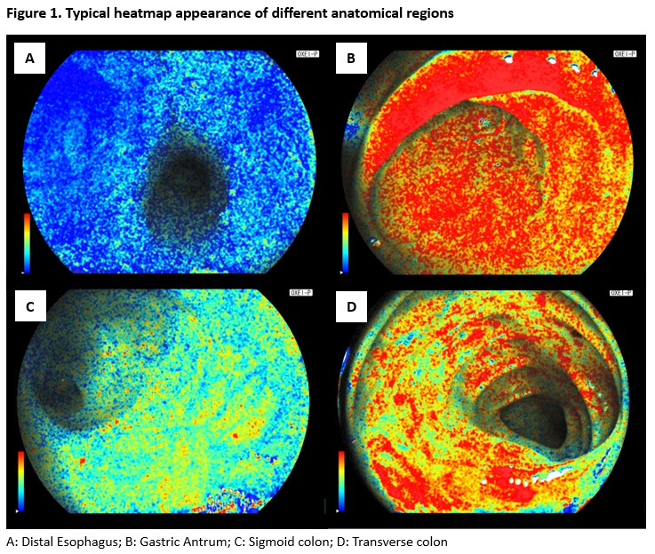Figure. Typical heatmap appearance of different anatomical regions