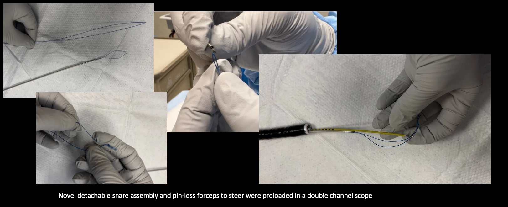 Image 2: Novel detachable snare assembly and pin-less forceps to steer were preloaded in a double-channel scope