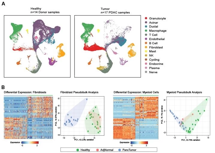 A) UMAP projection of single-cell RNA sequencing of donor pancreas, tumor, and tumor-adjacent “normal” tissue. B) Heatmap and pseudobulk PCA blots showing the distinct features of fibroblasts and myeloid cells in healthy versus tumor tissue.
