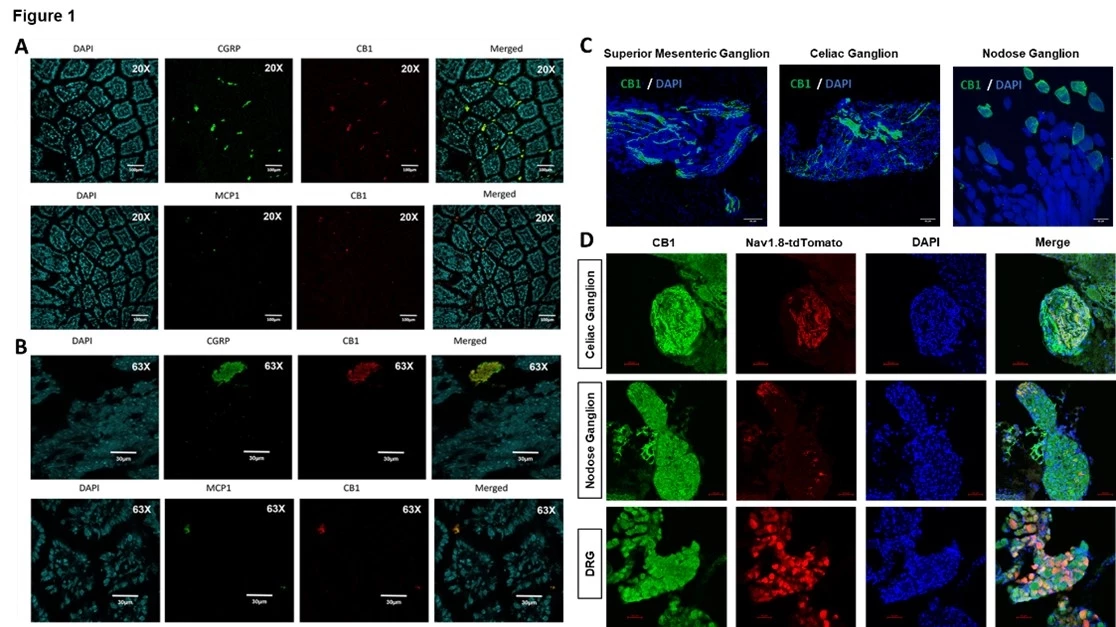 Figure 1. Strong co-localization of CB1 with markers of sensory/afferent neurons (calcitonin gene-related peptide [CGRP] and monocyte chemoattractant protein-1 [MCP1]) within the small intestine of HF diet-induced obese male C57Blk/6J mice. Co-immunostaining of CGRP or MCP1 (Green) with CB1 (Red) within the small intestine of HF diet-induced obese male C57Blk/6J mice at magnification of (A) 20X and (B) 63X. (C) CB1 immunostaining of cross-sections of the superior mesenteric ganglion, the celiac ganglion, and the nodose ganglion (CB1 = Green, DAPI= Blue). (D) CB1 immunostaining (Green) of cross-sections of the celiac ganglion, nodose ganglion, and dorsal root ganglion of Nav.1.8-tdTomato(Red) mice , DAPI= Blue. n=4-5 mice.