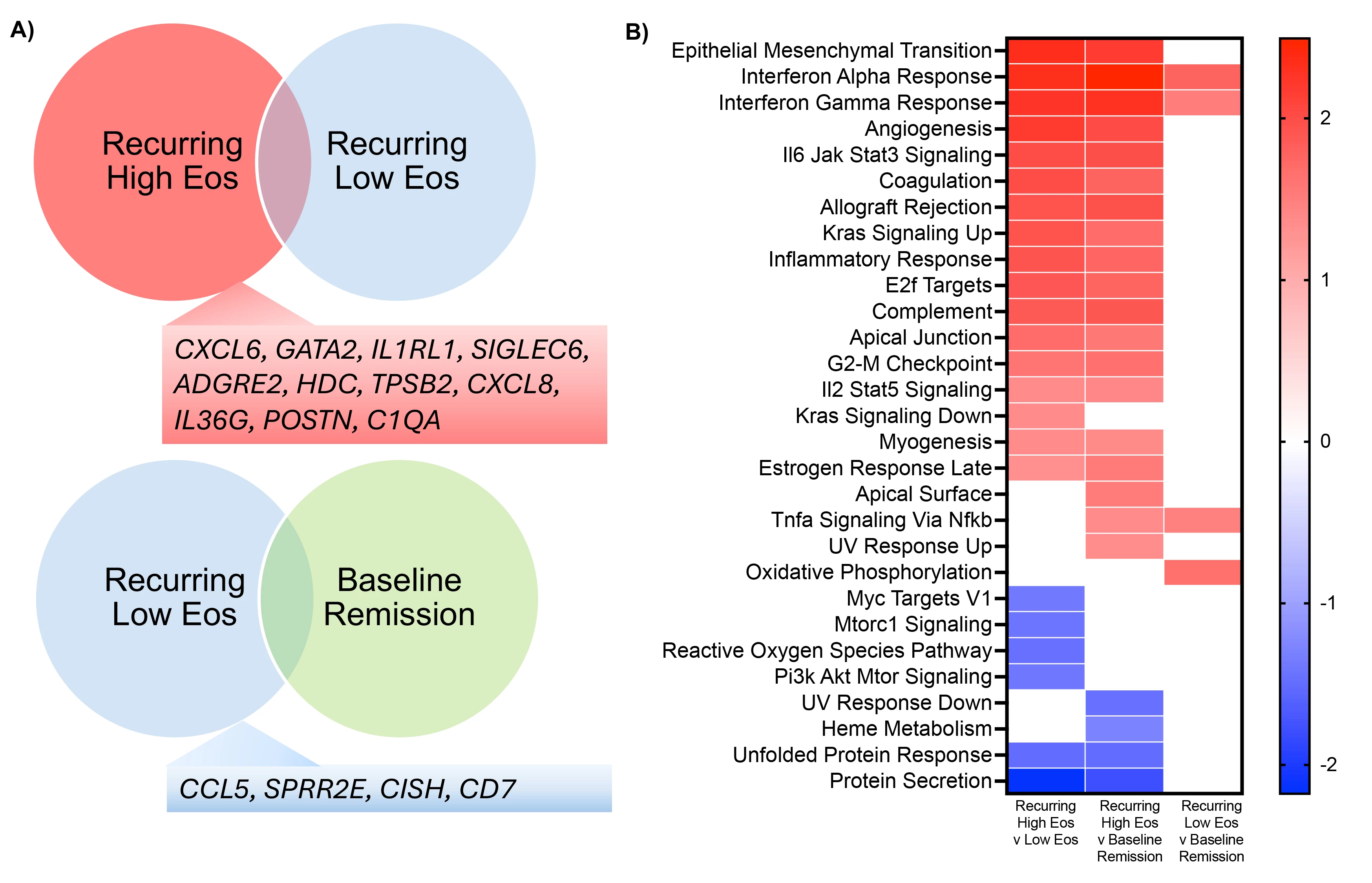 Figure 2. <b>A)</b> Showing differentially expressed genes (DEGs) of potential interest for paired patient category comparison, recurring high eosinophil tissue compared to recurring low eosinophil tissue (fold-change >2, adj p-value <0.05, total 1098 DEGs) and recurring low eosinophil tissue compared to baseline remission tissue (fold-change >1.5, adj p-value <0.05, total 120 DEGs). <b>B)</b> Hallmark GSEA pathway heatmap of paired patient categories: baseline remission and recurring high eosinophil and low eosinophil tissue (n=5), showing normalized enrichment scores for pathways with FDR 10%.
