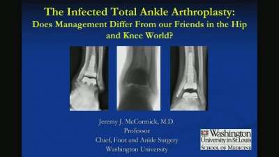 Foot and Ankle Injuries in Athletes: Getting to the Finish Line ...