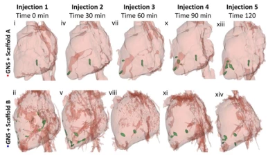 Thumbnail for Use of computed tomography segmentation to identify a hydrogel delivery of gold nanoshells in cardiac tissue