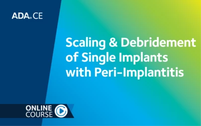 Thumbnail for Scaling & Debridement of Single Implants with Peri-Implantitis (2026 CDT Codes: Clinical Practice Series Part 5)