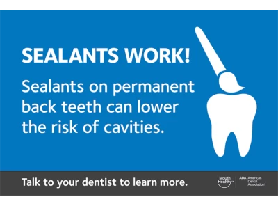 Thumbnail for Dental Recall Card – Sealants Work