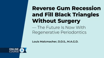Thumbnail for Reverse Gum Recession and Fill Black Triangles Without Surgery – The Future Is Now With Regenerative Periodontics