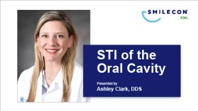 Thumbnail for STI of the Oral Cavity