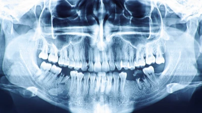 ADA Clinical Recommendations: Optimizing Radiation Safety in Dentistry ...