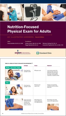 Thumbnail for Nutrition-Focused Physical Exam for Adults: An Illustrated Handbook, Second Edition