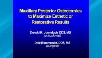 Thumbnail for 2007 - AAO Interdisciplinary Conference - Maxillary Posterior Osteotomies to Maximize Esthetic or Restorative Results