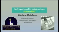 Thumbnail for 2018 AAO Annual Session - Tooth Impaction and the Hooked Root Apex: Cause or Effect?