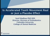 Thumbnail for 2018 AAO Annual Session - Is Accelerated Tooth Movement Real or Just a Placebo Effect?