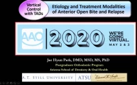 Thumbnail for Vertical Control with TADs: Etiology and Treatment of Anterior Open Bite and Relapse