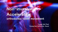 Thumbnail for Photobiomodulation: Light Accelerated Orthodontics to Reduce Treatment Duration