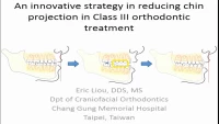 Thumbnail for An Innovative Strategy in Reducing Chin Projection in Class III Orthodontic Treatment
