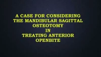 Thumbnail for A Case for Considering the Mandibular Sagittal Osteotomy in Treating Anterior Openbite