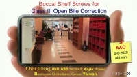 Thumbnail for Buccal Shelf (BS) Screws for Class III Openbite Correction