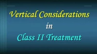 Thumbnail for Vertical Considerations in Class II Treatment